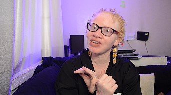 The Revelation- My Journey To albinism advocacy